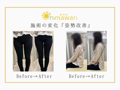 整体院 ヒマワリ(himawari)の写真