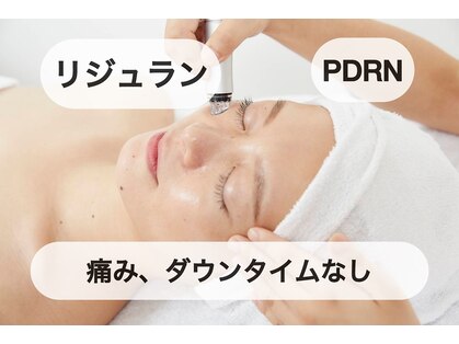 アニスの写真