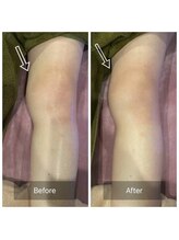 ルリアンデュレ(le lien durer)/膝の痛み(>_<)でご来店→施術後