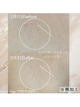 ケア ラウンジ ザ ファースト(THE F1RST)/背中改善＊