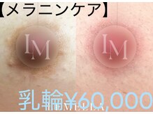 エム(M MaKe yourself shine)の雰囲気(韓国シェアNo.1黒ずみ徹底改善し生まれ持った透明美肌へ!)