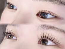 アド アール(add R)