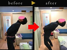 杉本接骨鍼灸院/若々しい背骨を取り戻す整体