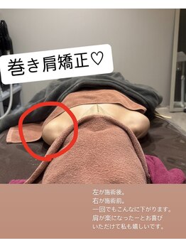 ルミナ(RUMINA)/巻き肩矯正