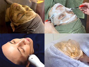 アート ビューティールーム(art beauty room)の写真/☆弾むハリ・潤う艶肌・なめらか素肌☆注目のフェイシャルで美白・くすみ・毛穴・シミ・シワ・ニキビケア♪