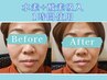 人気No.3【最新美容コース】全身リンパマッサージ&水素+酸素吸入 60分
