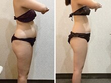 ウェリナ平和堂長久手院/小顔矯正/骨盤矯正/美脚サロン