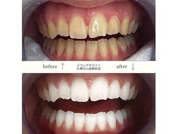 エクシアホワイト 北24条駅前店
