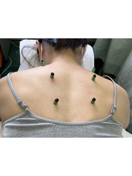 疲れを解消したい