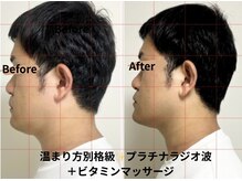 マリア(MALIA)/#南森町メンズフェイシャル