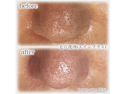 ルナ(LUNA)の写真