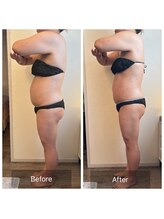 エヌア(nA)/2ヶ月プラン♪40代週1回5回目◎