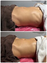 サニー(SUNNY)/腸もみ