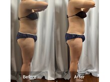 インナーメス(INNER MES)/全身の痩身で足も軽くなる！