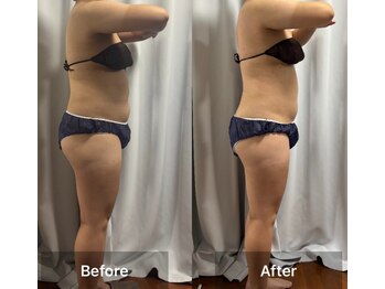 インナーメス(INNER MES)/全身の痩身で足も軽くなる!