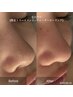 【毛穴ケア】詰まり/たるみ/開き毛穴徹底改善!時短ケア60分15800円→7500円