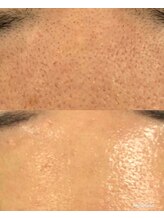 アミナス(Total Beauty Salon AMINAS)/REVI　ビフォーアフター