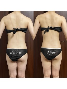 ヴィム(VIM)/ハイパーナイフビフォーアフター