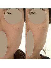 ディア(DIA)/【年齢肌に特化☆】