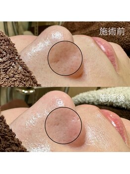 エクラ バイ シャンリィ(eclat by shanLy)/乾燥する時期注意