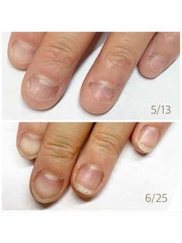 リネイル 長浜(Re-na-iL)/【今だけ】無料相談