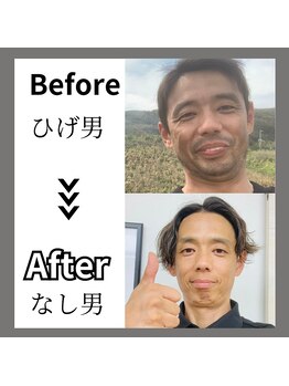 ミライキング(mirai king)/ビフォーアフター