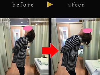 杉本接骨鍼灸院/若々しい背骨を取り戻す整体