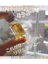 トリアングル(TLIENGLE)/エステでリジュランが打てる！！