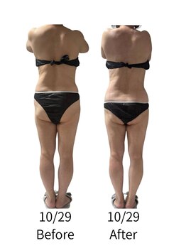 ララナ バイ カノア(LALANA by kanoa)/お尻半分になっちゃった～！