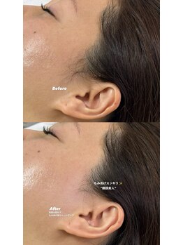 ラシサ(LASHISA)/フェイスワックス(パーツ)