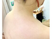 サロンヤザワ(Salon yazawa)/襟足のシェービング