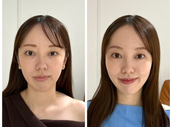 シュシュビエン(Chou Chou Bien)/似合うメイクで自信を引き出す