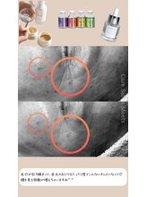 ミーツ(Meets)/ラエッセのWピーリング [人形町]