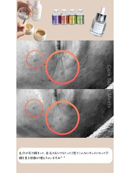 ミーツ(Meets)/ラエッセのWピーリング [人形町]