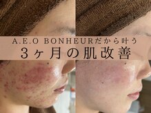 アエオボンヌール(A.E.O BONHEUR)