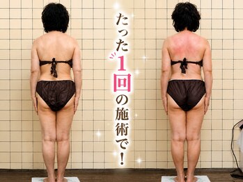 ナナ(NANA)の写真/「えっ、もう変わった！？」その場で実感する劇的ボディライン。気になる部位を狙い撃ちで見た目痩せ！