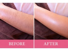 マロズワックス ブラジリアンワックスアンドスパ(Maro's Wax Brazilianwax Spa)/腕・ひじ下Wax★Before After