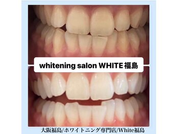 ホワイトニングサロン ホワイト(WHITE)/セルフホワイトニング/大阪/福島