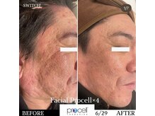 ヒルナム(Heal Nam)/プロセルセラピーズ　~フェイス~