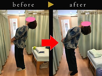 杉本接骨鍼灸院/若々しい背骨を取り戻す整体
