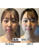 語 かたりべ/【エステ】ビフォー・アフター