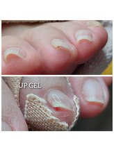 爪切り屋 足楽/【UPジェル】