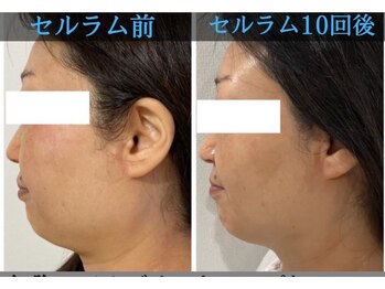 フレア(FULEA)/セルラム