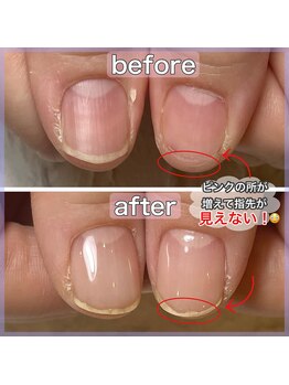 マッシュ MACHELA店(MASHU)/MISA 自爪育成