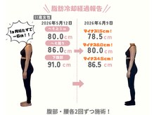 ココ(COCO)の雰囲気(結果の出る痩身/脂肪冷却)