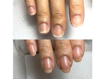 ミリアネイル 成城(Miliea nail)/自爪育成美爪クリア