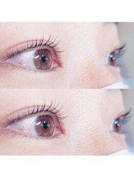 ゼン(Zen)/ラッシュリフト