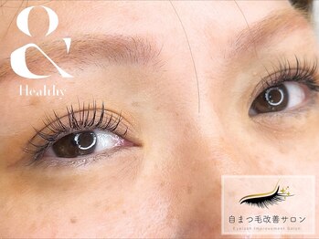 ウィンクルム(VINCULUM)/&ヘルシー/エクステパーマ