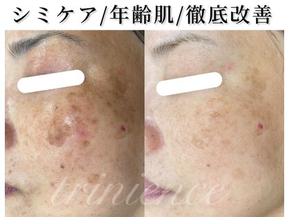 トリニエンス 南流山店の写真
