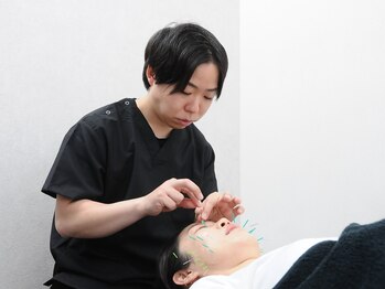 フロー鍼灸整体院(FLOW鍼灸整体院)の写真/【むくみ/小顔/美肌】小顔矯正＋リフトUP美容鍼で小顔だけでなく、肌荒れや毛穴の改善にも◎